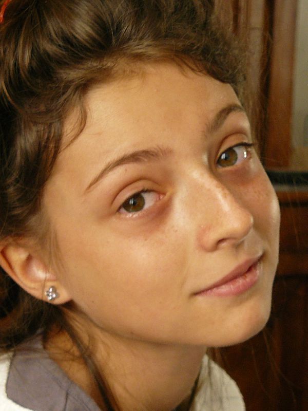 Le salon la tache de rousseur le bronzage