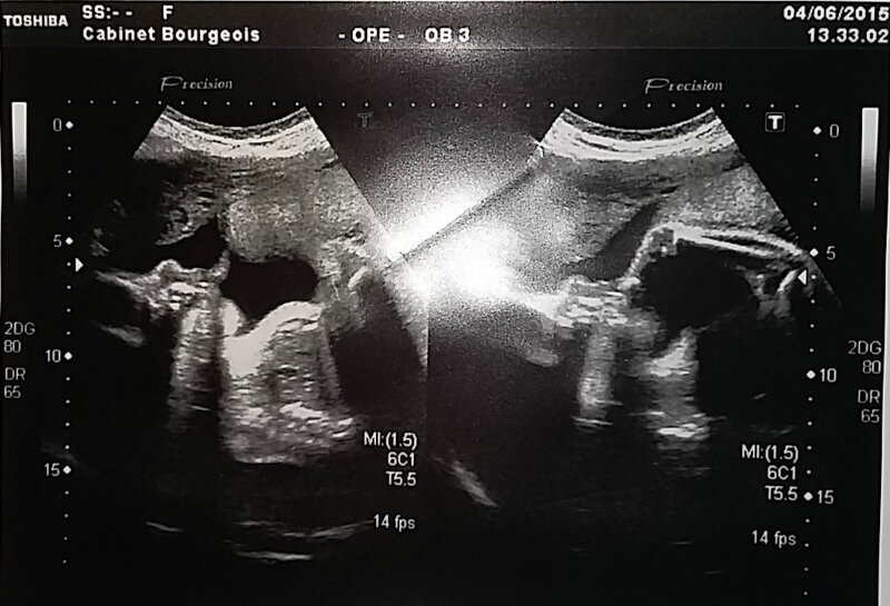 Bebe Grandit Bien Un Jour Une Bonne Etoile